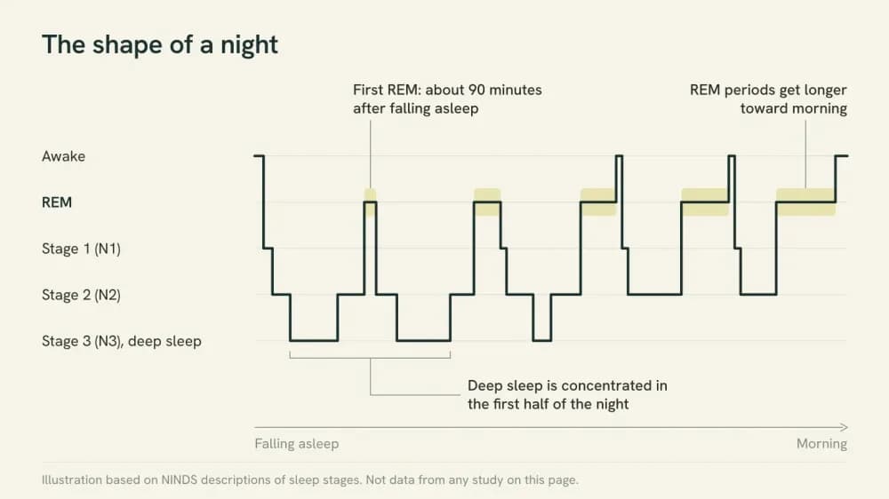 Illustrated chart of a typical night of sleep moving between awake, REM and non-REM stages, with deep sleep clustered early in the night and REM periods growing longer toward morning.